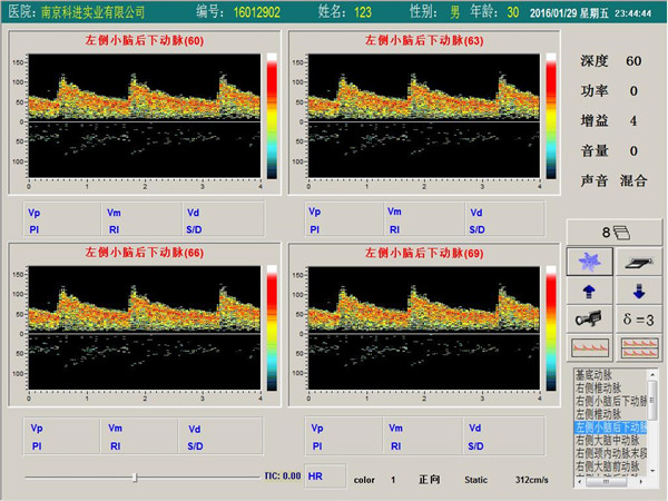 經顱多普勒單通道，四深度界面