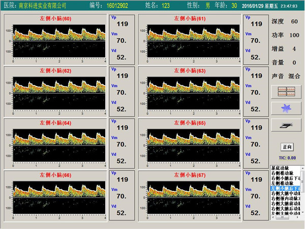 經顱多普勒單通道，八深度界面